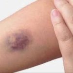 7 Reasons to Rub Aloe Vera on Your Face and Skin – Aloe Vera Benefits for Skin