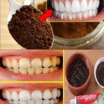 Cheesy Spinach Casserole Recipe