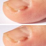 Whoa never heard of this before, but the benefits are wild