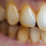 Stop purchasing lettuce. Here’s how to easily grow it in a pot at home.