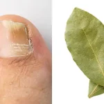 Mix Vaseline with Lemon and You’ll Be Surprised!