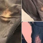 What Are These Mysterious Red Capsules Found on the Bed?