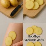 How to eliminate bed bugs – Powerful mix with cloves