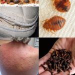 Say Goodbye to Varicose Veins Forever with Just 1 Potato