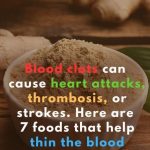 This Is Why Some Window Grills Have a Curve at the Bottom