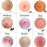 Preparing Lemon Powder Is Very Easy: A Simple Pinch Is Enough to Enhance Your Desserts and Dishes