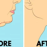 Homemade Natural Antibiotic Syrup: Your Go-To Remedy for Coughs