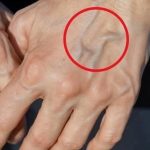 Easy Zucchini Rosti with eggs