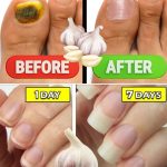 Mix Clove and Ginger : The Indian Secret No One Will Ever Tell You