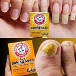 Top 3 Ways to Treat Tooth Decay with Guava Leaves – Simple and Cost-Effective