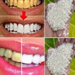 Grandma’s Remedy for Varicose Veins: A Natural Recipe with Aloe Vera, Apple Cider Vinegar, and Lemon