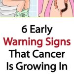 I’m Losing So Much Belly Fat Drinking This All Day!  My Big Belly Is Gone – Thanks to Ginger!