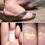 The Ultimate Herbal Eye Care Remedy: Keep Your Vision Healthy with This Simple DIY Solution