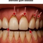 Just hang a handful of these leaves in front of your door – flies and mosquitoes will disappear