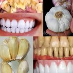 Perfect Baked Potato Recipe