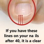 If Lines Start Appearing On Your Nails After 40, It Could Be A Warning Sign