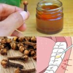 Boiling Cloves and Orange Peel: A Simple Home Remedy for Better Health