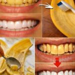 Garlic: The Forgotten Kitchen Duo That Can Transform Your Health After 50