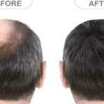 The best vitamin to eliminate poor circulation in legs and feet.