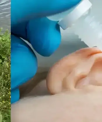 Mullein and Ear Problems: Nature’s Remedy for Gentle Relief